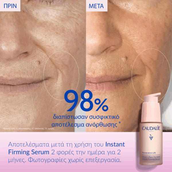 Caudalie Resveratrol-Lift Instant Firming Αντιγηραντικό Serum Προσώπου με Υαλουρονικό Οξύ & Κολλαγόνο για Lifting & Σύσφιξη 30ml - Image 6
