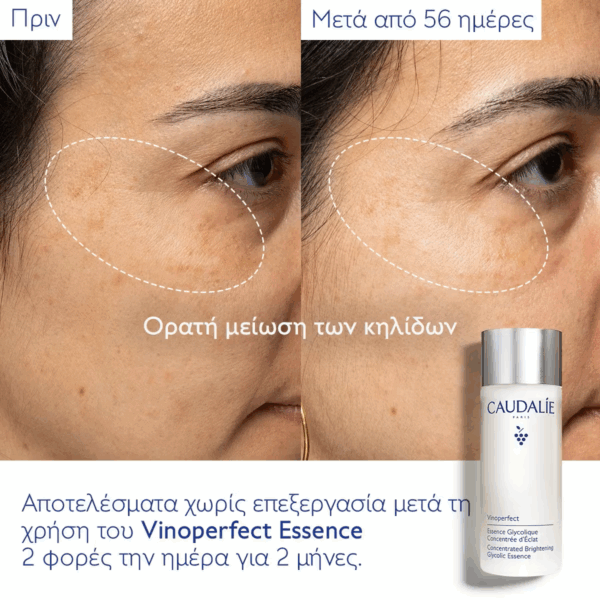 Caudalie Vinoperfect Αντιγηραντικό Essence Προσώπου 100ml - Image 3