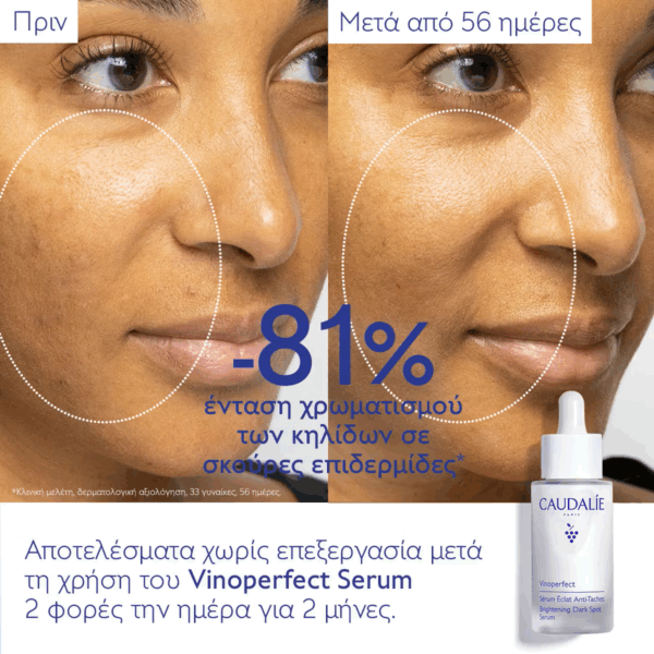 Caudalie Vinoperfect Καταπραϋντικό & Ενυδατικό Serum Προσώπου για Λάμψη & Αναζωογόνηση 50ml - Image 5