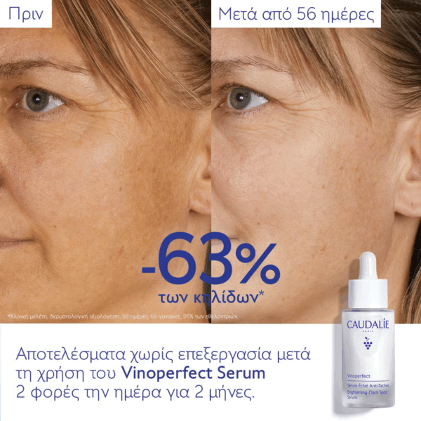 Caudalie Vinoperfect Brightening Dark Spot Serum Προσώπου για Λάμψη & Πανάδες 30ml - Image 7