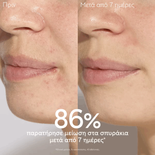 Caudalie Vinopure Serum Προσώπου 30ml - Image 4