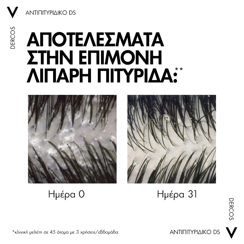 Vichy Promo (-20%) Dercos Anti-Dandruff DS Shampoo Αντιπιτυριδικό Σαμπουάν για Ξηρά Μαλλιά, 390ml - Image 7