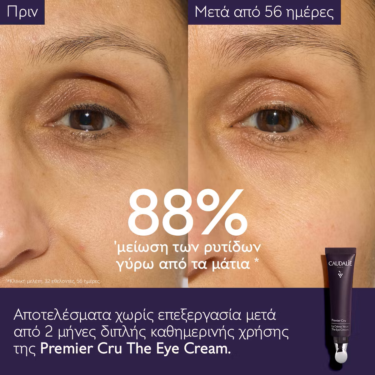 Caudalie Ultimate Anti-Aging Solution Travel Set για Αντιγήρανση 3τμχ - Image 3