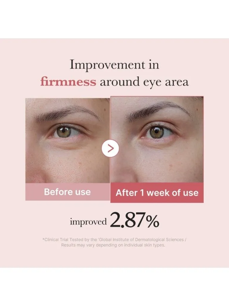 Medicube PDRN Pink Peptide Eye Cream Κρέμα Ματιών με Ρετινόλη & Πεπτίδια 30ml - Image 2