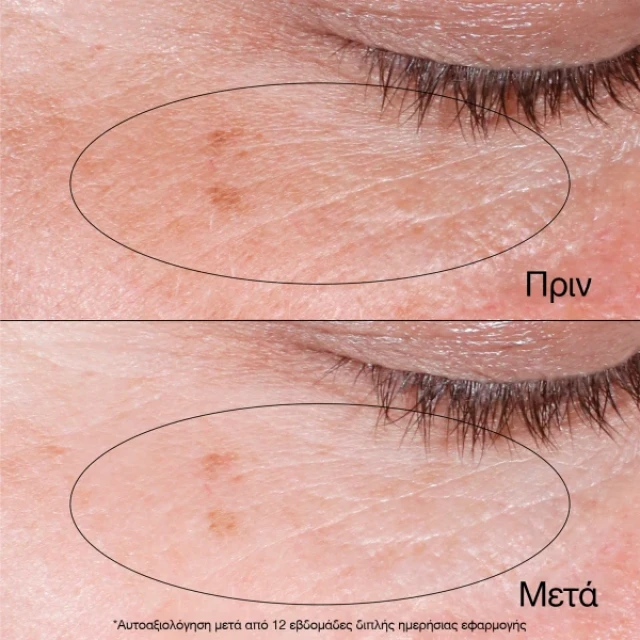 Neutrogena Collagen Bank Eye Gel Cream Αναζωογονητική Κρέμα Ματιών 15gr - Image 2