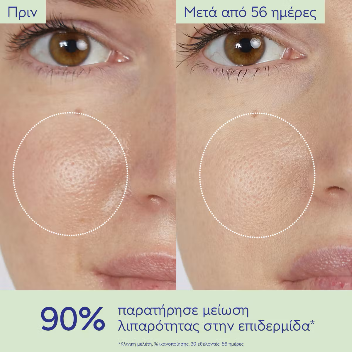 Caudalie Vinopure Lotion Τόνωσης Προσώπου για Λιπαρές Επιδερμίδες 200ml - Image 4
