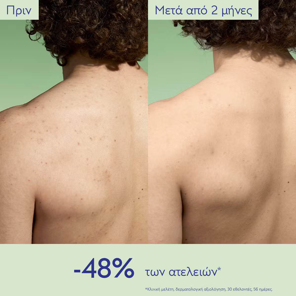 Caudalie Vinopure Lotion Τόνωσης Προσώπου για Λιπαρές Επιδερμίδες 200ml - Image 7
